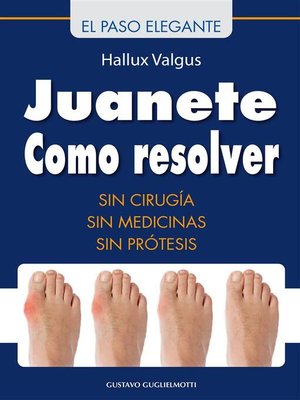 Juanete--Resolver sin cirugía - ebook
